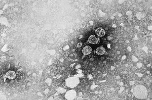 Archivo:Hepatitis B virus 01
