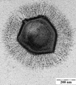 Electron microscopic image of a mimivirus - journal.ppat.1000087.g007 crop.png