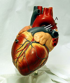 Archivo:Heart frontally PDA