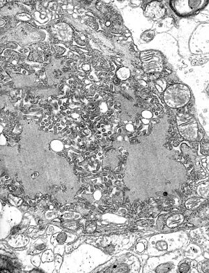Archivo:Rabies Virus EM PHIL 1876