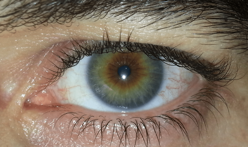 Hazel eye1