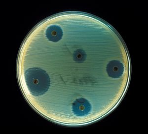 Archivo:Staphylococcus aureus (AB Test)