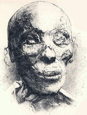 Archivo:ThutmoseII-mummy-head-drawing