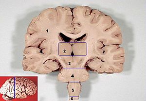 Archivo:Human brain frontal (coronal) section description