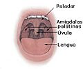 Amigdalas diag