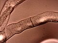 Neurospora crassahyphae