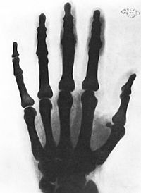 Archivo:Рэнтгенаўскі здымак рукі Тэслы