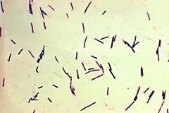 Clostridium perfringens.jpg
