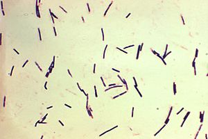 Archivo:Clostridium perfringens