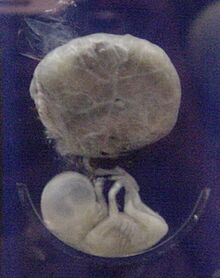 Archivo:Fetus 3 months