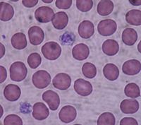 Archivo:Giant platelets