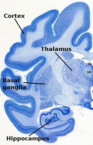 Archivo:Chlorocebus-nissl-brainmaps