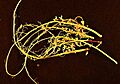 Soybean-root-nodules