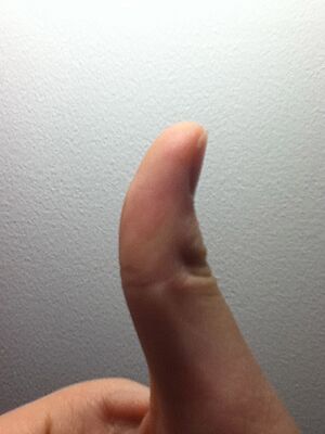 Archivo:Thumb