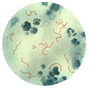 Archivo:Streptococcus pyogenes 01