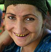 Archivo:Tajikistan gold teeth