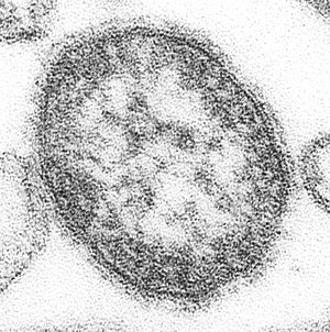 Archivo:Measles virus