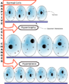 Hyperplasia vs Hypertrophy