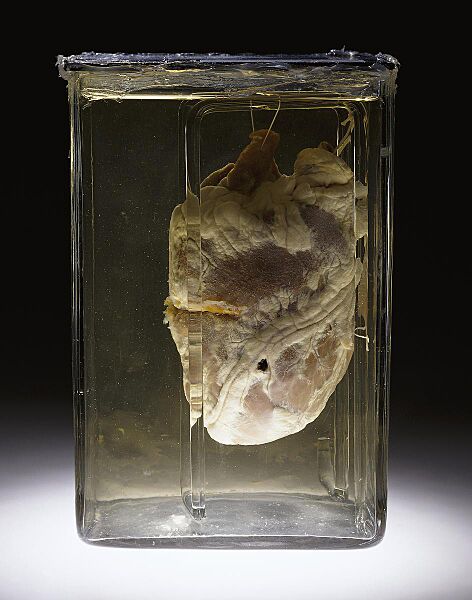 Gunshot heart