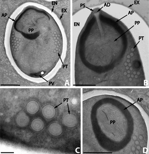 Archivo:Parasite140019-fig4 Nosema podocotyloidis - Hyperparasitic Microsporidia
