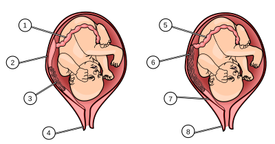 Archivo:Tipos de Placenta