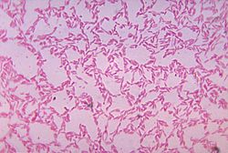 Bacteroides biacutis 01.jpg