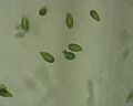 Gonyostomum-cells