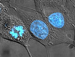 Archivo:HeLa cells stained with Hoechst 33258