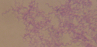 Archivo:Bacteria púrpura
