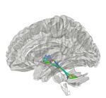 Archivo:Superior Cerebellar Peduncle