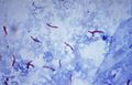 Mycobacterium tuberculosis Ziehl-Neelsen stain 02