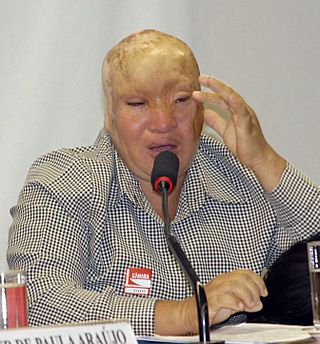 Presidente das mulheres escalpeladas do Amapá.jpg