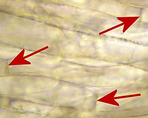 Archivo:2009-07-02 Hyphae with septa