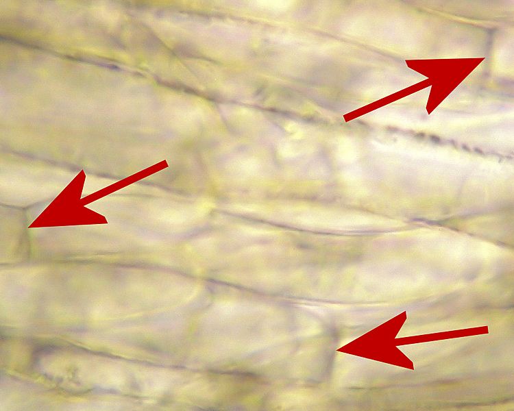 2009-07-02 Hyphae with septa