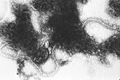 Respiratory syncytial virus 01