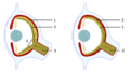 Evolution eye 2
