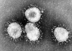 Archivo:Coronaviruses 004 lores