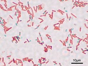 Archivo:Bacillus subtilis Spore