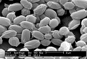 Archivo:Anthrax spores