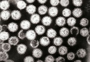 Archivo:Multiple rotavirus particles