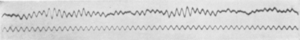 Archivo:1st-eeg