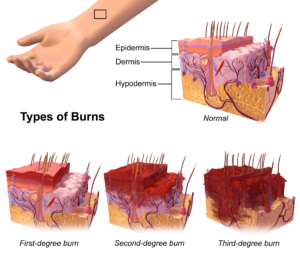 Archivo:Burns