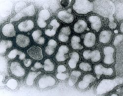 Archivo:Influenza A - late passage