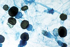 Archivo:Rhizopus zygospores