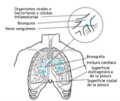 Acute-bronchitis-es