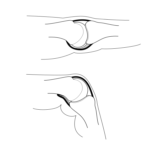 Metacarpophalangeal joint illustration