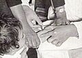 Polio Vaccination 1950s (cropped)