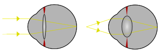 Focus in an eye.svg