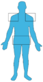 Polymyalgia rheumatica man