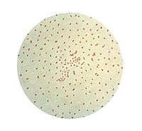 Archivo:Bordetella pertussis